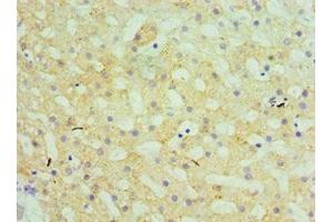 Immunohistochemistry of paraffin-embedded human liver tissue using ABIN7154176 at dilution of 1:100 (GATM 抗体  (AA 124-423))
