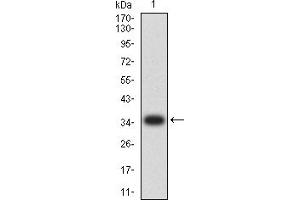 Western blot analysis using CCND1 mAb against human CCND1 (AA: 1-295) recombinant protein.