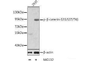 Western blot analysis of extracts of 293T cells using Phospho-β-catenin(S33/S37/T41) Polyclonal Antibody. (beta Catenin 抗体  (pSer33, pSer37, pThr41))