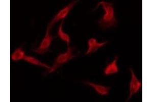 Immunofluorescence (fixed cells) (IF/ICC) image for anti-Prostaglandin E Receptor 3 (Subtype EP3) (PTGER3) (C-Term) antibody (ABIN6257004)