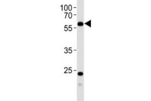 Western blot analysis of lysate from human kidney tissue using PFKFB3 antibody at 1:1000. (PFKFB3 抗体  (AA 454-484))