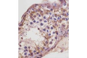 (ABIN6243319 and ABIN6578857) staining TGFBR3 in human testis tissue sections by Immunohistochemistry (IHC-P - paraformaldehyde-fixed, paraffin-embedded sections). (TGFBR3 抗体  (AA 285-319))
