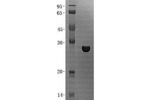 Validation with Western Blot (PDAP1 Protein (His tag))