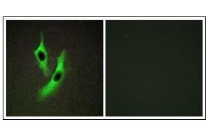 Immunofluorescence analysis of HeLa cells, using STEAP4 Antibody. (STEAP4 抗体)