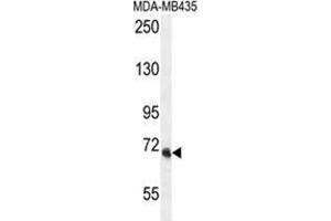 VPS52 Antibody (C-term) western blot analysis in MDA-MB435 cell line lysates (35 µg/lane). (VPS52 抗体  (C-Term))