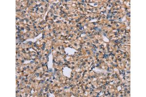 Immunohistochemistry (IHC) image for anti-ADAM Metallopeptidase Domain 29 (ADAM29) antibody (ABIN2427053) (ADAM29 抗体)