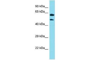 Western Blotting (WB) image for anti-Keratin 39 (KRT39) (N-Term) antibody (ABIN2791629) (Keratin 39 (KRT39) (N-Term) 抗体)