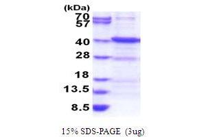 Ankyrin Repeat, Family A (RFXANK-Like), 2 (ANKRA2) (AA 1-313) protein (His tag)