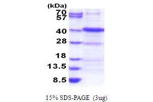 SDS-PAGE (SDS) image for Ankyrin Repeat, Family A (RFXANK-Like), 2 (ANKRA2) (AA 1-313) protein (His tag) (ABIN6387472) (ANKRA2 Protein (AA 1-313) (His tag))