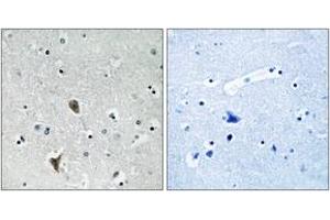 Immunohistochemistry analysis of paraffin-embedded human brain tissue, using OXR1 Antibody. (OXR1 抗体  (AA 472-521))
