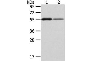 Gel: 8 % SDS-PAGE, Lysate: 40 μg, Lane 1-2: Human thyroid cancer and normal stomach tissue, Primary antibody: ABIN7193074(XKR3 Antibody) at dilution 1/200 dilution, Secondary antibody: Goat anti rabbit IgG at 1/8000 dilution, Exposure time: 2 minutes (XKR3 抗体)