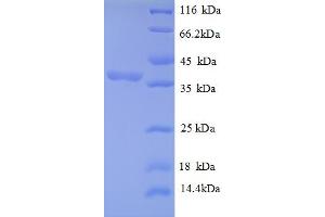 SDS-PAGE (SDS) image for Ribosomal Protein, Large, P2 (RPLP2) (AA 1-113), (partial) protein (GST tag) (ABIN5712217)