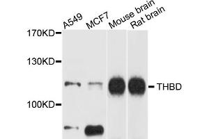 Western blot analysis of extracts of various cell lines, using THBD antibody (ABIN5972294) at 1/1000 dilution. (Thrombomodulin 抗体)
