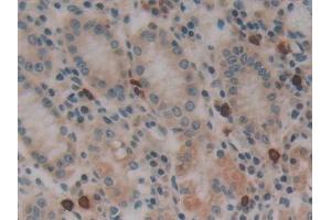 Detection of DNM2 in Human Stomach Tissue using Polyclonal Antibody to Dynamin 2 (DNM2)