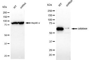 Western blotting analysis using catalase antibody (ABIN7797921). (Recombinant Catalase 抗体)
