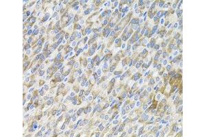 Immunohistochemistry of paraffin-embedded Mouse stomach using MBL2 Polyclonal Antibody (MBL2 抗体)