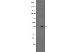 Western blot analysis of VSX1 expression in K562 cell line lysate ;,The lane on the left is treated with the antigen-specific peptide. (VSX1 抗体  (C-Term))