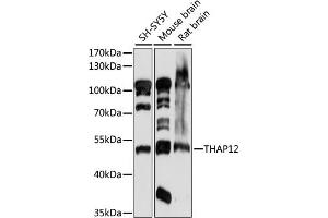 Western blot analysis of extracts of various cell lines, using TH antibody (ABIN7269714) at 1:1000 dilution.