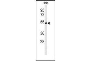 Western blot analysis of K2C78 Antibody (Center) in Hela cell line lysates (35ug/lane). (Keratin 78 抗体  (Middle Region))