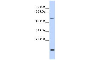 WB Suggested Anti-FOXN3 Antibody Titration:  0. (FOXN3 抗体  (Middle Region))