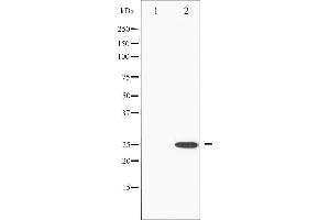 Western blot analysis of RhoA phosphorylation expression in HeLa whole cell lysates,The lane on the left is treated with the antigen-specific peptide. (RHOA 抗体  (pSer188))