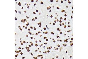 Immunohistochemistry of paraffin-embedded rat brain using Phospho-STA-Y694 antibody (ABIN6135328, ABIN6136272, ABIN6136273 and ABIN7101887) at dilution of 1:100 (40x lens). (STAT5A 抗体  (pTyr694))