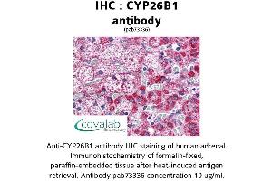 Image no. 1 for anti-Cytochrome P450, Family 26, Subfamily B, Polypeptide 1 (CYP26B1) (AA 160-396) antibody (ABIN1733454) (CYP26B1 抗体  (AA 160-396))