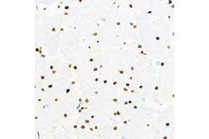 Immunohistochemistry of paraffin-embedded mouse brain using ZEB2 Rabbit pAb (ABIN6131480, ABIN6150424, ABIN6150425 and ABIN6221369) at dilution of 1:100 (40x lens). (ZEB2 抗体  (AA 1050-1214))