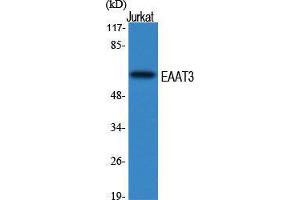 Western Blot (WB) analysis of specific cells using EAAT3 Polyclonal Antibody. (SLC1A1 抗体  (Internal Region))