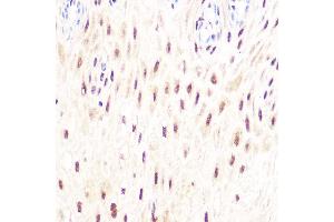 Immunohistochemistry of paraffin-embedded human esophageal using DP1/TFDP1 Rabbit mAb (ABIN7270891) at dilution of 1:100 (40x lens). (DP1 抗体)