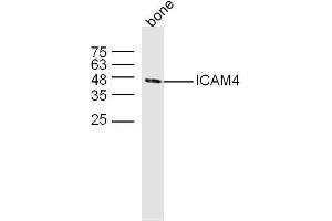 Mouse bone lysates probed with ICAM4 Polyclonal Antibody, unconjugated  at 1:300 overnight at 4°C followed by a conjugated secondary antibody at 1:10000 for 60 minutes at 37°C. (ICAM4 抗体  (AA 85-180))