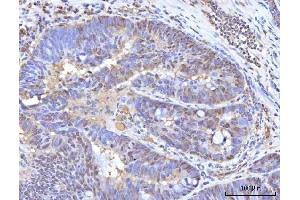 IHC analysis of RANBP2 using anti-RANBP2 antibody (ABIN7602650). (RANBP2 抗体  (AA 906-2744))