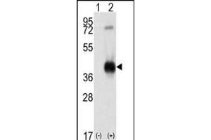 Western blot analysis of CK1 (arrow) using rabbit polyclonal CK1 Antibody (C-term) (ABIN391310 and ABIN2841344). (CAMK1 抗体  (C-Term))