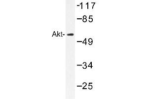 Image no. 1 for anti-V-Akt Murine Thymoma Viral Oncogene Homolog 1 (AKT1) antibody (ABIN272119) (AKT1 抗体)