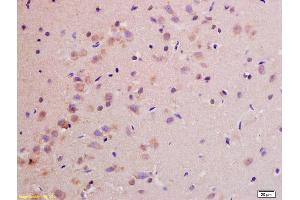 Formalin-fixed and paraffin embedded rat brain labeled with Rabbit Anti NDUFS1(75kD) Polyclonal Antibody, Unconjugated (ABIN750703) at 1:200 followed by conjugation to the secondary antibody and DAB staining (NDUFS1 抗体  (AA 51-150))