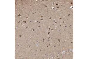 Immunohistochemical staining of human cerebral cortex with PLCH1 polyclonal antibody  shows moderate cytoplasmic positivity in neuronal cells. (PLCH1 抗体)