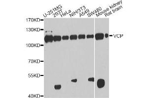 Western blot analysis of extracts of various cell lines, using VCP antibody. (VCP 抗体  (AA 647-806))