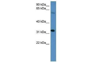 Hoxd13 antibody used at 0.