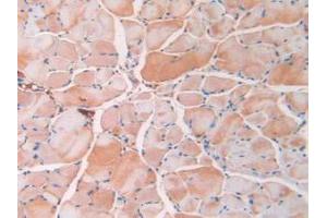 IHC-P analysis of Mouse Skeletal Muscle Tissue, with DAB staining. (Resistin 抗体  (AA 21-114))