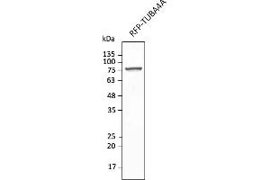Western Blotting (WB) image for anti-tdTomato Fluorescent Protein (tdTomato) antibody (DyLight 550) (ABIN7273113) (tdTomato 抗体  (DyLight 550))
