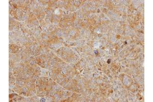 IHC-P Image Immunohistochemical analysis of paraffin-embedded SW480 xenograft, using CHI3L2, antibody at 1:500 dilution. (CHI3L2 抗体)