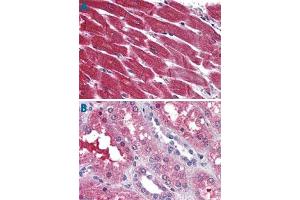 Immunohistochemistry (Formalin/PFA-fixed paraffin-embedded sections) of human heart (A) and human kidney tissue (B) with S1PR3 polyclonal antibody . (S1PR3 抗体  (N-Term))
