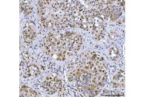 IHC analysis of STAG2 using anti-STAG2 antibody (ABIN7602420).