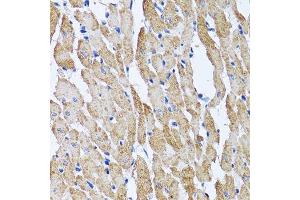Immunohistochemistry (Paraffin-embedded Sections) (IHC (p)) image for anti-ATP Synthase, H+ Transporting, Mitochondrial F1 Complex, beta Polypeptide (ATP5B) (AA 230-529) antibody (ABIN6137326)