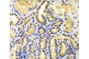 Immunohistochemistry of paraffin-embedded Human kidney using EIF5A Polyclonal Antibody at dilution of 1:100 (40x lens). (EIF5A 抗体)