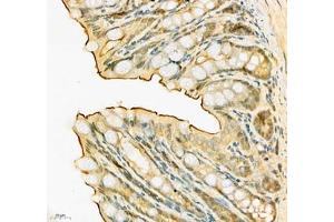 Immunohistochemistry (Paraffin-embedded Sections) (IHC (p)) image for anti-Solute Carrier Family 6 (Neutral Amino Acid Transporter), Member 19 (SLC6A19) antibody (ABIN7075682)