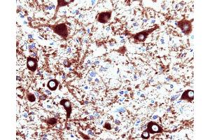 Dynamin (clone 41) staining on rat brain. (Dynamin 1 抗体  (AA 698-851))
