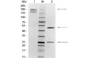 SDS-PAGE of Mouse anti-Mesothelin Monoclonal Antibody. (Mesothelin 抗体)