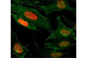 ICC/IF test of HeLa cells treated with sodium butyrate using recombinant H3K4ac antibody (red). (Recombinant Histone 3 抗体  (acLys4))
