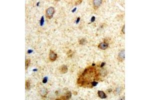 Immunohistochemical analysis of Clipin A staining in human brain formalin fixed paraffin embedded tissue section. (Coronin 1a 抗体)